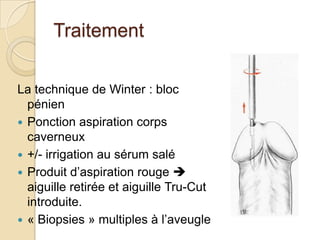 TraitementPonction des corps caverneux :Bord latéral de la verge ou directement en trans-glandulaire (anastomose caverno-spongieuse.) Sang d’autant plus noir et visqueux que épisode aura duré plus longtemps. Masser doucement verge et laisser couler sang. Aiguille retirée quand sang rouge apparaît.