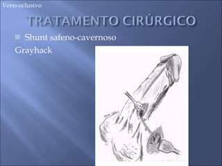 Shunt safeno-cavernoso  Grayhack Veno-oclusivo 
