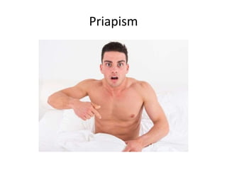 Priapism
 