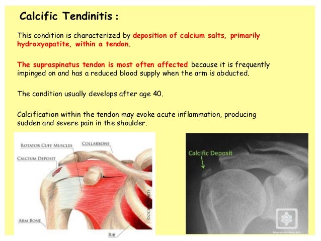 Periarticular Disorders of the Extremities