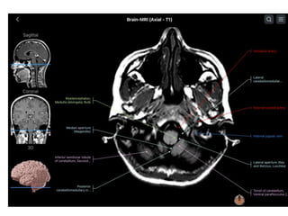PRICIPLES OF MRI BRAIN FINAL COPY.pptx