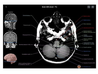 PRICIPLES OF MRI BRAIN FINAL COPY.pptx