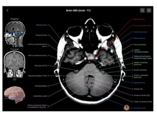 PRICIPLES OF MRI BRAIN FINAL COPY.pptx