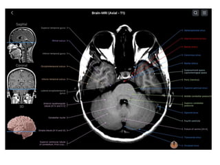 PRICIPLES OF MRI BRAIN FINAL COPY.pptx