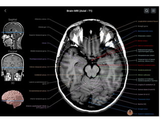 PRICIPLES OF MRI BRAIN FINAL COPY.pptx