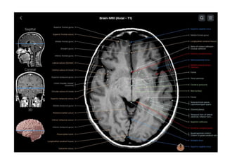 PRICIPLES OF MRI BRAIN FINAL COPY.pptx