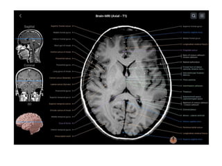 PRICIPLES OF MRI BRAIN FINAL COPY.pptx