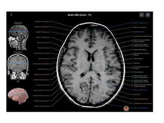 PRICIPLES OF MRI BRAIN FINAL COPY.pptx