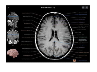 PRICIPLES OF MRI BRAIN FINAL COPY.pptx
