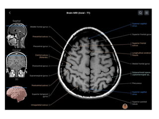 PRICIPLES OF MRI BRAIN FINAL COPY.pptx