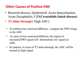 PRICIPLES OF MRI BRAIN FINAL COPY.pptx