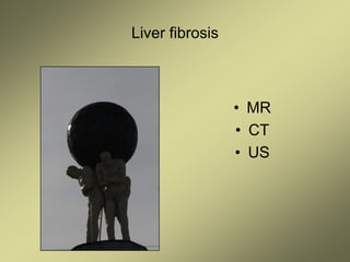 Liver fibrosis
• MR
• CT
• US
 
