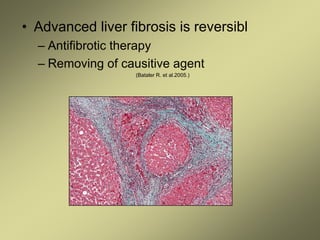 • Advanced liver fibrosis is reversibl
– Antifibrotic therapy
– Removing of causitive agent
(Bataler R. et al.2005.)
 