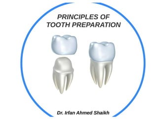 Prienciple of tooth prepration