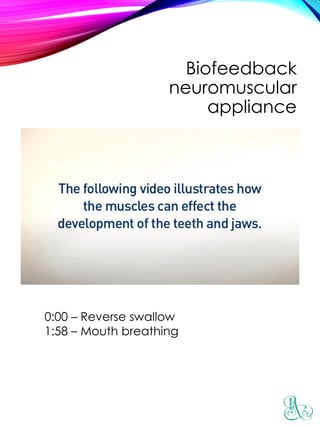 Biofeedback
neuromuscular
appliance
0:00 – Reverse swallow
1:58 – Mouth breathing
 