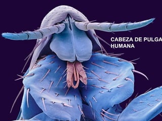 CABEZA DE PULGA
HUMANA