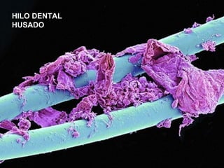HILO DENTAL
HUSADO