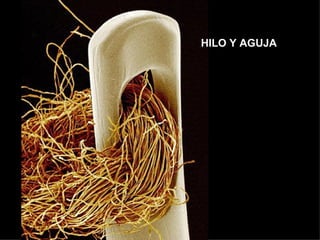 HILO Y AGUJA