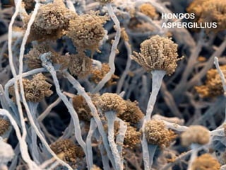 HONGOS
ASPERGILLIUS