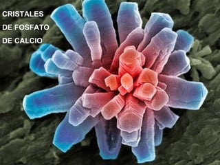 CRISTALES
DE FOSFATO
DE CALCIO