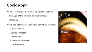 primary-open-angle-glaucoma-ppt guide.pptx