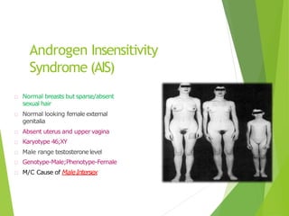 Androgen Insensitivity
Syndrome (AIS)
Normal breasts but sparse/absent
sexual hair
Normal looking female external
genitalia
Absent uterus and uppervagina
Karyotype 46;XY
Male range testosteronelevel
Genotype-Male;Phenotype-Female
M/C Cause of MaleIntersex
 