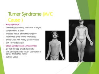 Turner Syndrome (M/C
Cause )
Karyotype 45;XO
Generally grow slowly so shorter inheight
Lymphadema at birth
Webbed neck & Short MetacarpalIV
Pigmented spots on the wholebody
Shield Chest with widely spaced Nipples
DM ;Thyroid disorder
Streakgonads/ovaries (Amenorrhea)
Do not develop breast atpuberty
CVS (Bicuspid aortic valve> Coarctationof
aorta) ;Horseshoe Kidney
Cubitus Valgus
 