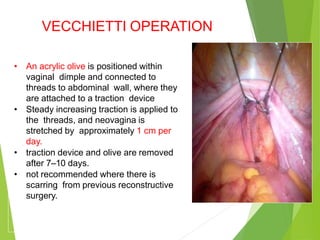 VECCHIETTI OPERATION
• An acrylic olive is positioned within
vaginal dimple and connected to
threads to abdominal wall, where they
are attached to a traction device
• Steady increasing traction is applied to
the threads, and neovagina is
stretched by approximately 1 cm per
day.
• traction device and olive are removed
after 7–10 days.
• not recommended where there is
scarring from previous reconstructive
surgery.
 