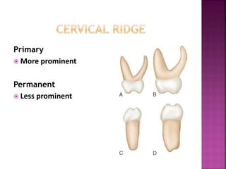Primary
 More prominent
Permanent
 Less prominent
 