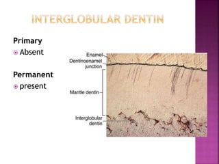 Primary
 Absent
Permanent
 present
 