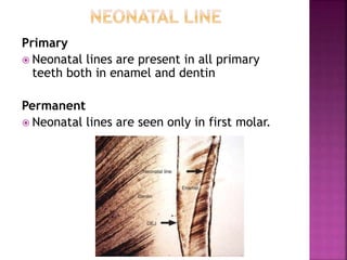 Primary
 Neonatal lines are present in all primary
teeth both in enamel and dentin
Permanent
 Neonatal lines are seen only in first molar.
 
