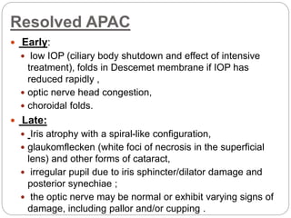 Resolved APAC
 Early:
 low IOP (ciliary body shutdown and effect of intensive
treatment), folds in Descemet membrane if IOP has
reduced rapidly ,
 optic nerve head congestion,
 choroidal folds.
 Late:
 Iris atrophy with a spiral-like configuration,
 glaukomflecken (white foci of necrosis in the superficial
lens) and other forms of cataract,
 irregular pupil due to iris sphincter/dilator damage and
posterior synechiae ;
 the optic nerve may be normal or exhibit varying signs of
damage, including pallor and/or cupping .
 