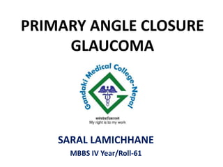 PRIMARY ANGLE CLOSURE
GLAUCOMA
SARAL LAMICHHANE
MBBS IV Year/Roll-61
 