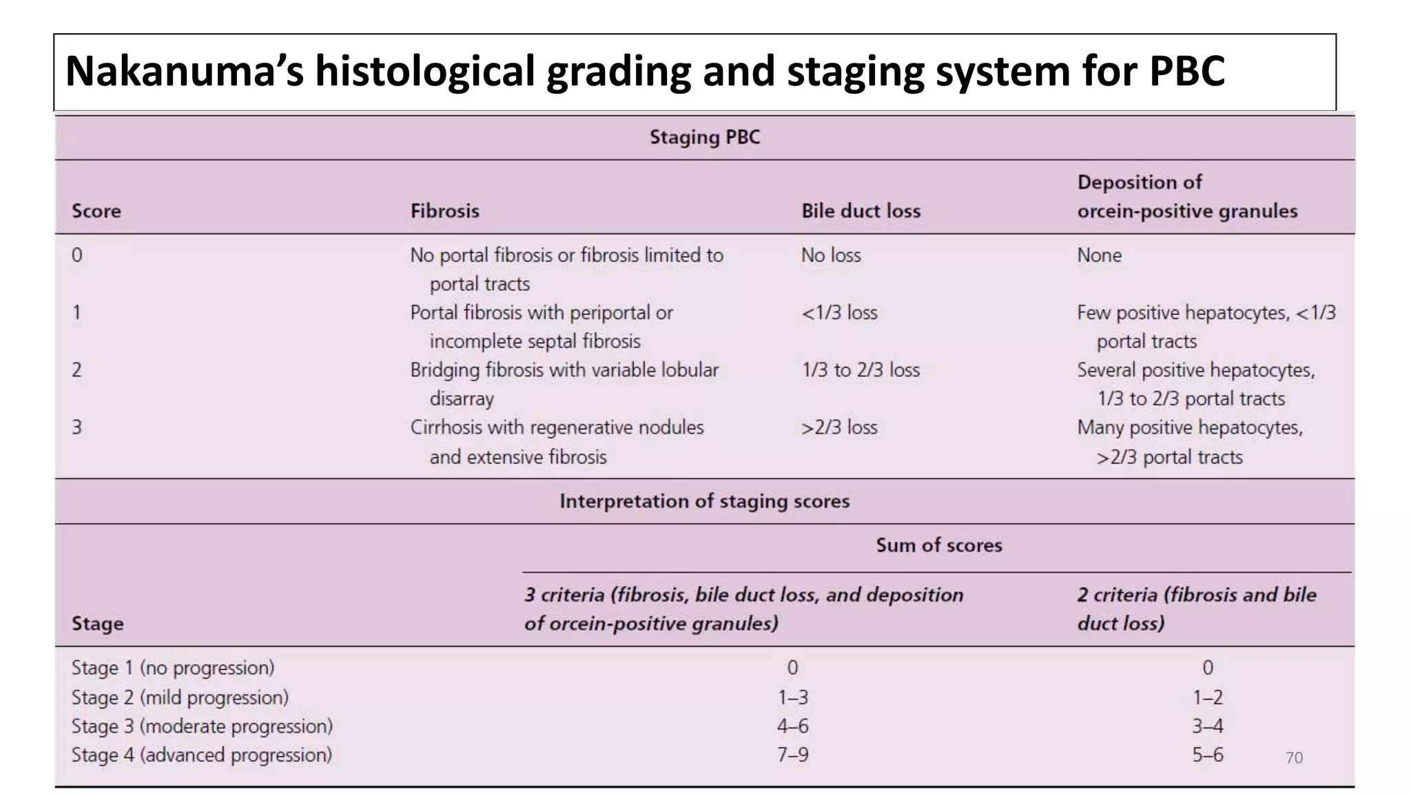 Nakanuma’s histological grading and staging system for PBC
70
 