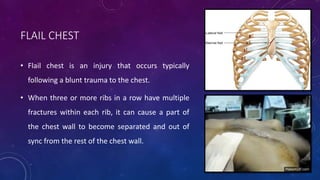 Primary care in trauma | PPTX