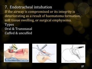 Criteria for intubation
Clinical
 Shortened speech
 Use of accessory muscles
 Subjective air hunger
 Change in mental ...