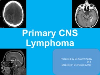 Primary CNS
Lymphoma
Presented by-Dr. Rashmi Yadav
JR-II
Moderator- Dr. Piyush Kumar
 