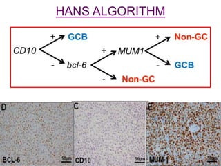 HANS ALGORITHM
 