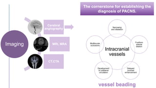 The cornerstone for establishing the
diagnosis of PACNS.
Imaging
Cerebral
angiography
MRI, MRA
CT,CTA
vessel beading
Intracranial
vessels
Narrowing
and dilatation
Fusiform
arterial
dilation
Delayed
contrast
enhancement
Development
of collateral
circulation
Multilocular
occlusions
 
