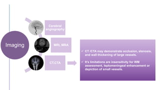  CT /CTA may demonstrate occlusion, stenosis,
and wall thickening of large vessels.
 It’s limitations are insensitivity for WM
assessment, leptomeningeal enhancement or
depiction of small vessels.
Imaging
Cerebral
angiography
MRI, MRA
CT,CTA
 