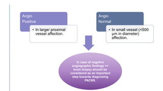 Angio
Positive
• In large/ proximal
vessel affection.
Angio
Normal
• In small vessel (<500
μm in diameter)
affection.
In case of negative
angiographic findings >>
brain biopsy should be
considered as an important
step towards diagnosing
PACNS.
 