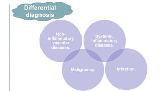 Differential
diagnosis
Non-
inflammatory
vascular
diseases.
Malignancy.
Systemic
inflammatory
diseases.
Infection.
 
