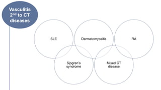 Vasculitis
2nd to CT
diseases
SLE
Sjogren’s
syndrome
Dermatomyositis
Mixed CT
disease
RA
 