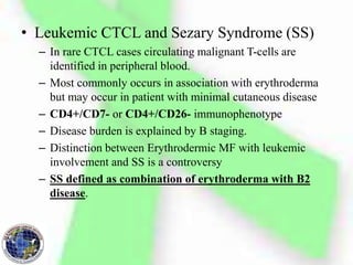 • Leukemic CTCL and Sezary Syndrome (SS)
– In rare CTCL cases circulating malignant T-cells are
identified in peripheral blood.
– Most commonly occurs in association with erythroderma
but may occur in patient with minimal cutaneous disease
– CD4+/CD7- or CD4+/CD26- immunophenotype
– Disease burden is explained by B staging.
– Distinction between Erythrodermic MF with leukemic
involvement and SS is a controversy
– SS defined as combination of erythroderma with B2
disease.
 