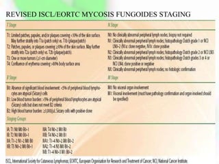 REVISED ISCL/EORTC MYCOSIS FUNGOIDES STAGING
 