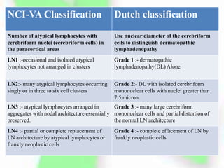 NCI-VA Classification Dutch classification
Number of atypical lymphocytes with
cerebriform nuclei (cerebriform cells) in
the paracortical areas
Use nuclear diameter of the cerebriform
cells to distinguish dermatopathic
lymphadenopathy
LN1 :-occasional and isolated atypical
lymphocytes not arranged in clusters
Grade 1 :- dermatopathic
lymphadenopathy(DL) Alone
LN2:- many atypical lymphocytes occurring
singly or in three to six cell clusters
Grade 2:- DL with isolated cerebriform
mononuclear cells with nuclei greater than
7.5 micron.
LN3 :- atypical lymphocytes arranged in
aggregates with nodal architecture essentially
preserved.
Grade 3 :- many large cerebriform
mononuclear cells and partial distortion of
the normal LN architecture
LN4 :- partial or complete replacement of
LN architecture by atypical lymphocytes or
frankly neoplastic cells
Grade 4 :- complete effacement of LN by
frankly neoplastic cells
 