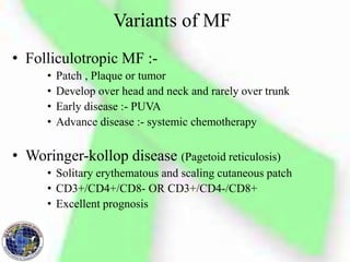 Variants of MF
• Folliculotropic MF :-
• Patch , Plaque or tumor
• Develop over head and neck and rarely over trunk
• Early disease :- PUVA
• Advance disease :- systemic chemotherapy
• Woringer-kollop disease (Pagetoid reticulosis)
• Solitary erythematous and scaling cutaneous patch
• CD3+/CD4+/CD8- OR CD3+/CD4-/CD8+
• Excellent prognosis
 