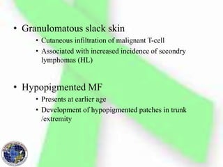 • Granulomatous slack skin
• Cutaneous infiltration of malignant T-cell
• Associated with increased incidence of secondry
lymphomas (HL)
• Hypopigmented MF
• Presents at earlier age
• Development of hypopigmented patches in trunk
/extremity
 