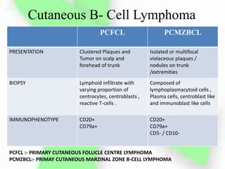 Cutaneous B- Cell Lymphoma
PCFCL PCMZBCL
PRESENTATION Clustered Plaques and
Tumor on scalp and
forehead of trunk
Isolated or multifocal
violaceous plaques /
nodules on trunk
/extremities
BIOPSY Lymphoid infiltrate with
varying proportion of
centrocytes, centroblasts ,
reactive T-cells .
Composed of
lymphoplasmacytoid cells ,
Plasma cells, centroblast like
and immunoblast like cells
IMMUNOPHENOTYPE CD20+
CD79a+
CD20+
CD79a+
CD5- / CD10-
PCFCL :- PRIMARY CUTANEOUS FOLLICLE CENTRE LYMPHOMA
PCMZBCL:- PRIMAY CUTANEOUS MARZINAL ZONE B-CELL LYMPHOMA
 