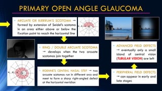 PRIMARY OPEN ANGLE GLAUCOMA
• ARCUATE OR BJERRUM’S SCOTOMA 
formed by extension of Seidel’s scotoma
in an area either abo...